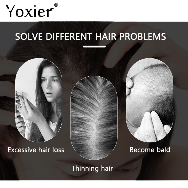 Intensive Growth Serum Prevent - Hair Care Serum review and price