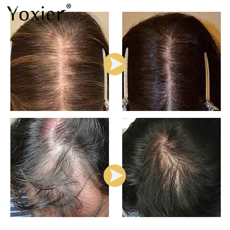 Intensive Growth Serum Prevent - Hair Care Serum review and price