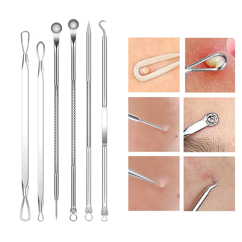 4-11Pcs Ingrown Hair Tweezers  - Hair Care Tools review and price