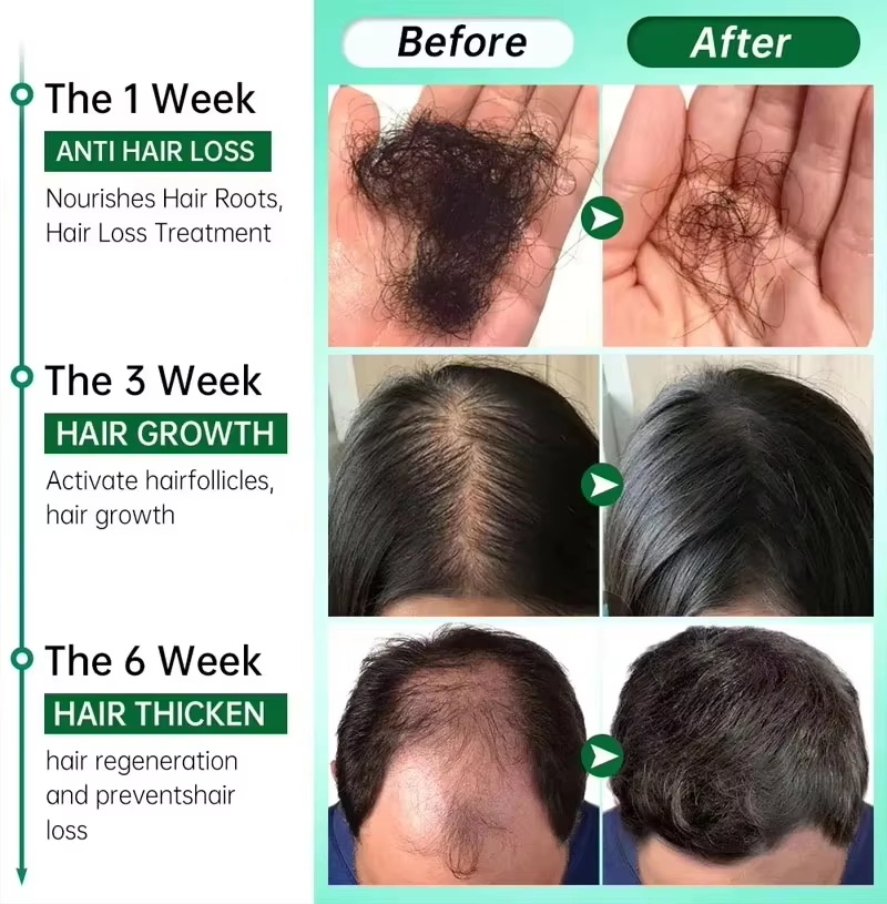 Hair Growth Serum 7 Days Fast  - Hair Care Capsule review and price