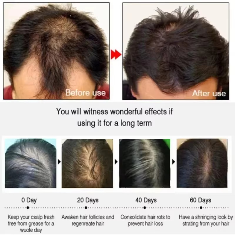 Hair Growth Serum 7 Days Fast  - Hair Care Capsule review and price