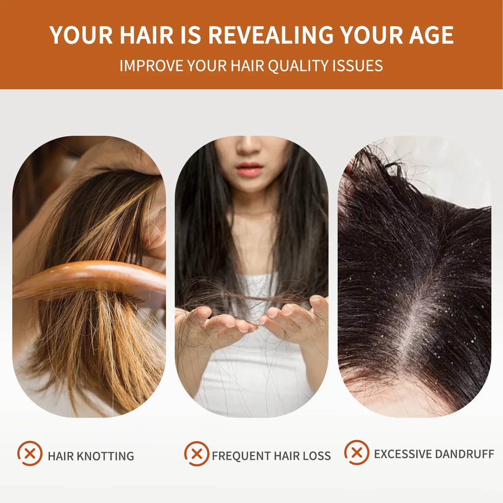 4 Bars of Anti-Hair Loss Shamp - Rosemary Hair Oil review and price
